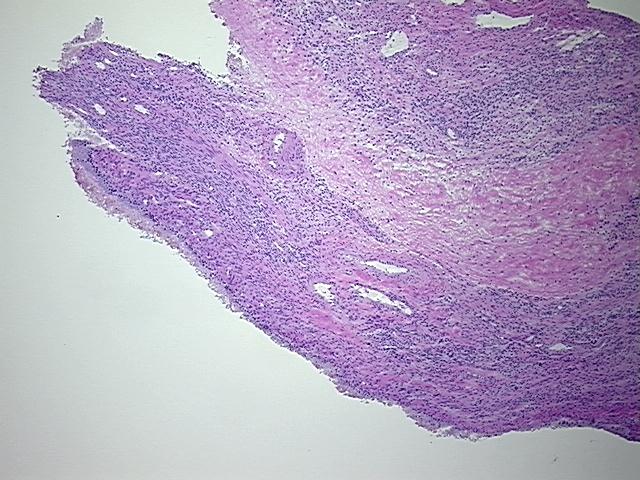 4x Image