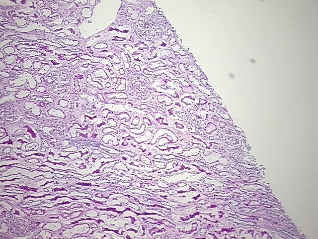 4x Image