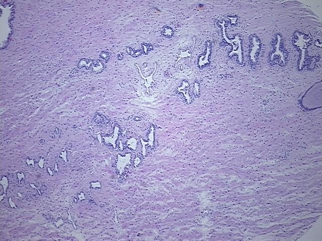 4x Image