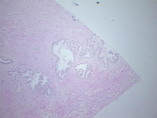 4x Image