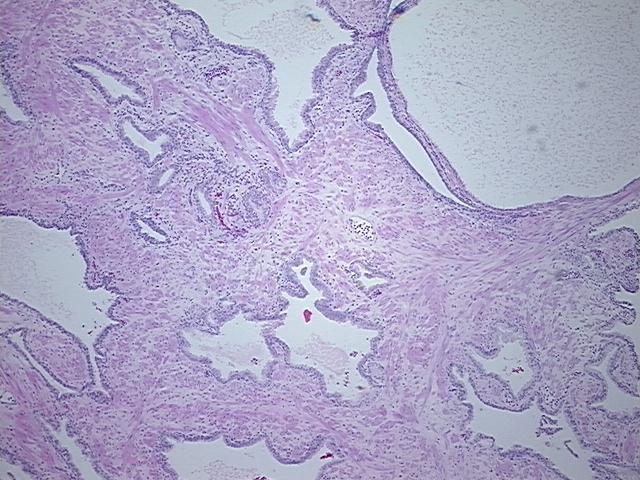 4x Image