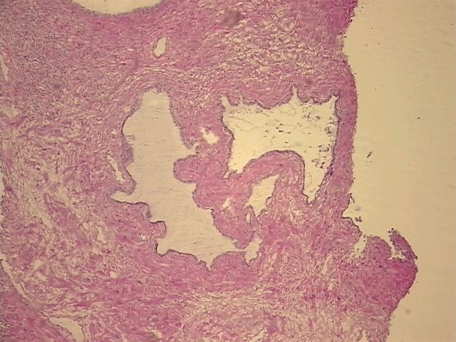 4x Image