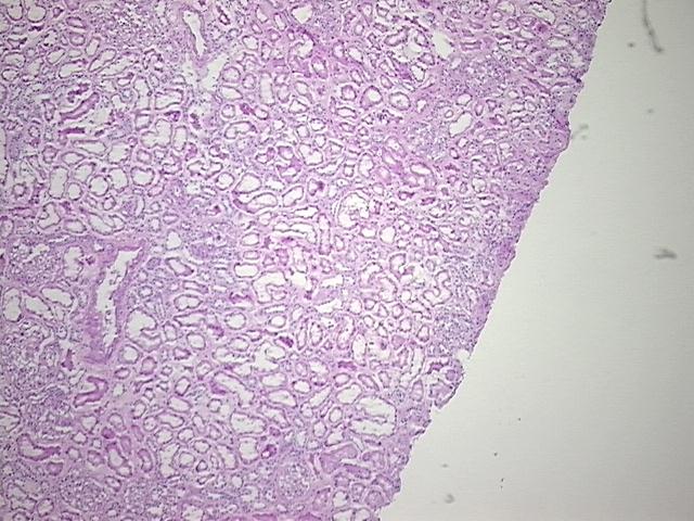 4x Image