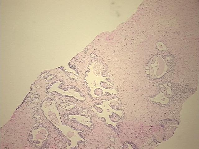 4x Image