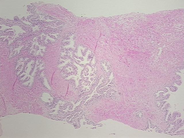 4x Image