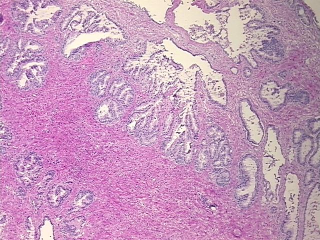 Frozen Tissue Sections, Prostate