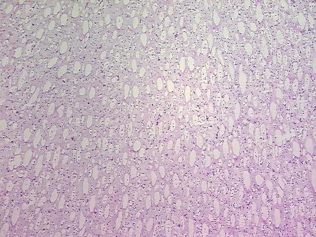 4x Image