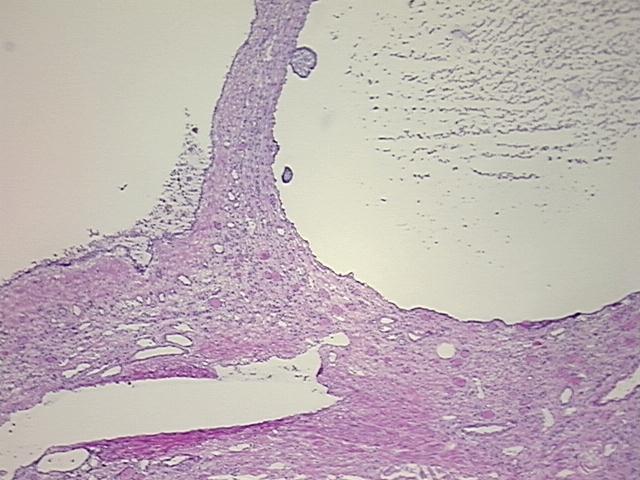 4x Image