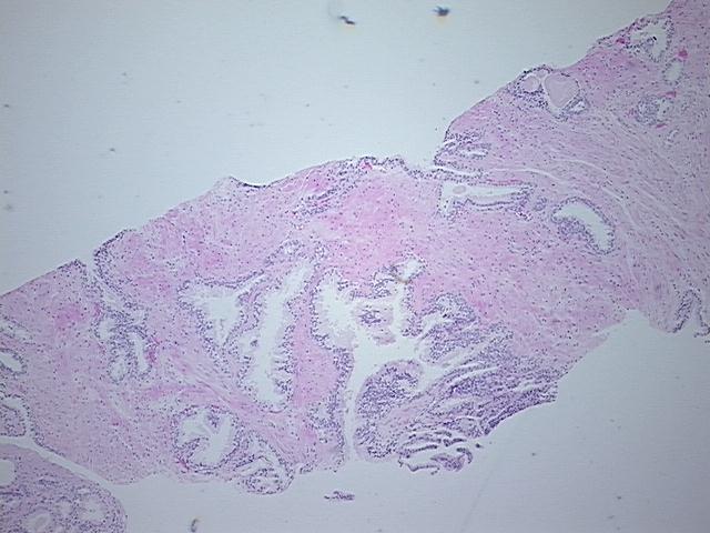 4x Image