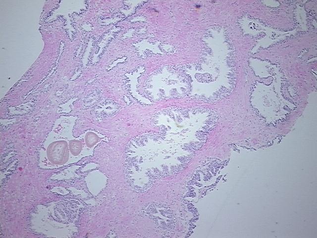 4x Image