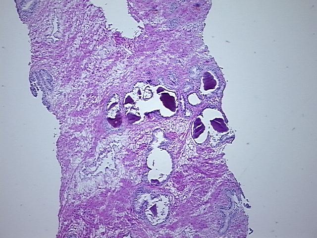 4x Image