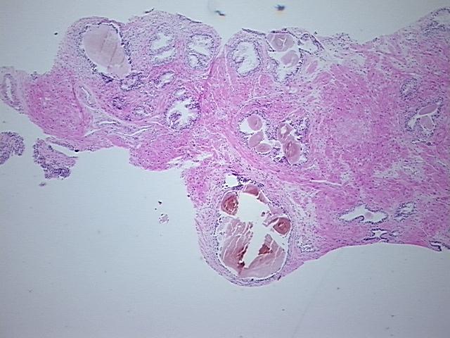 4x Image