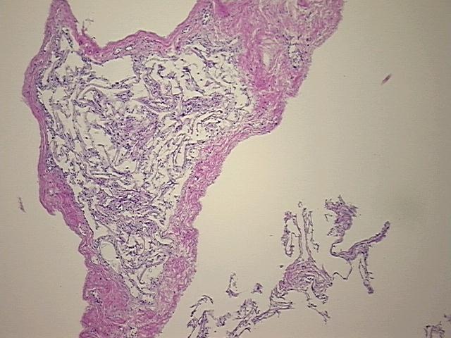 4x Image