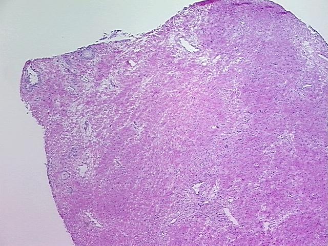 4x Image