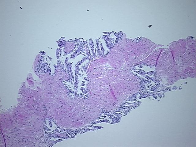 4x Image