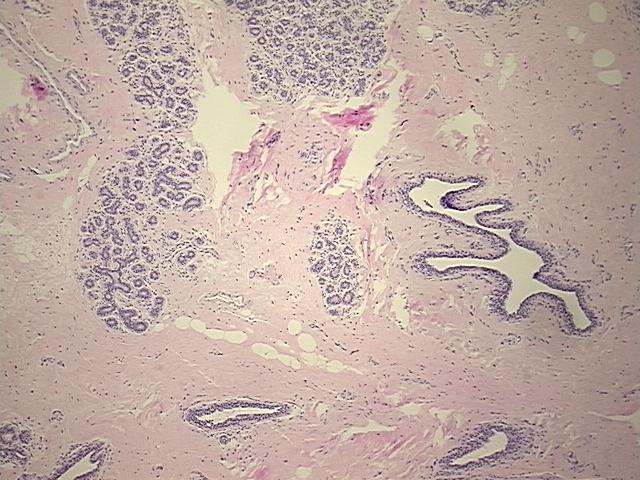 4x Image