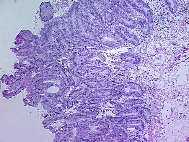 4x Image