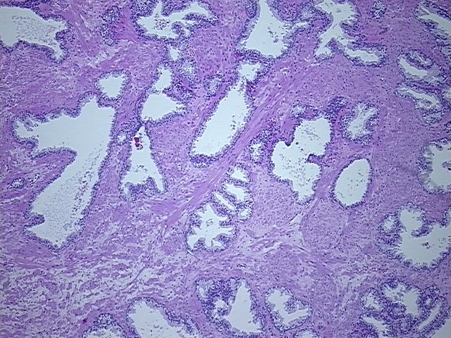 4x Image