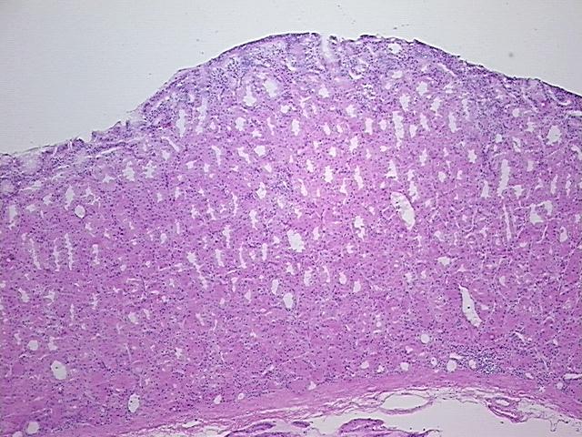 4x Image
