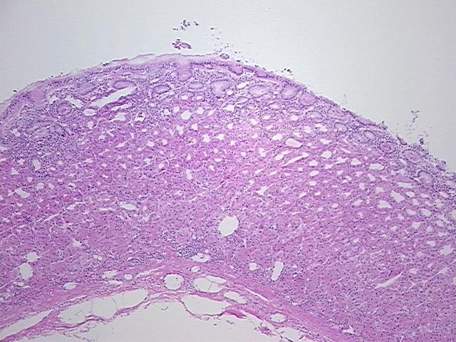 4x Image