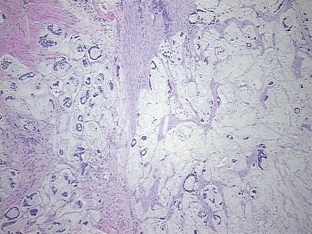 4x Image