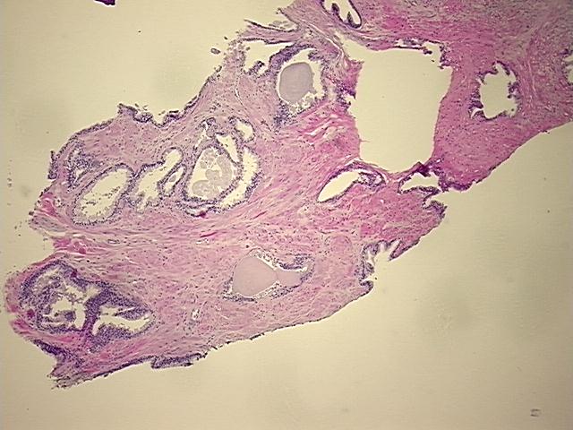 4x Image