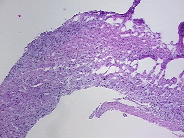 4x Image