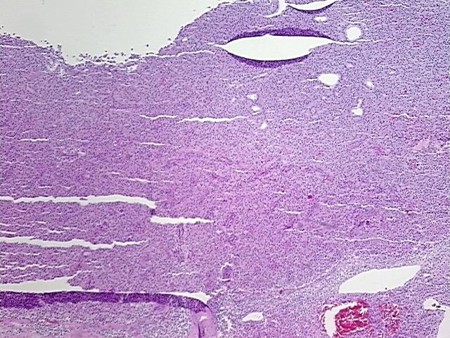 4x Image