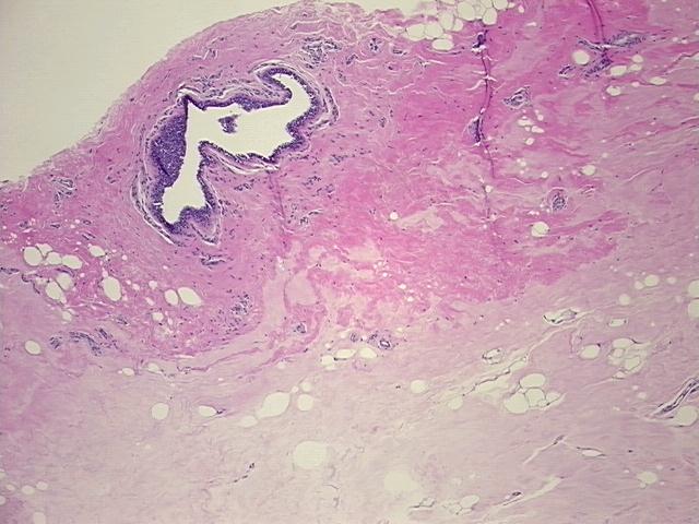 4x Image