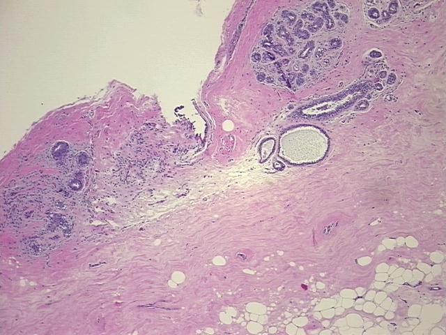 4x Image