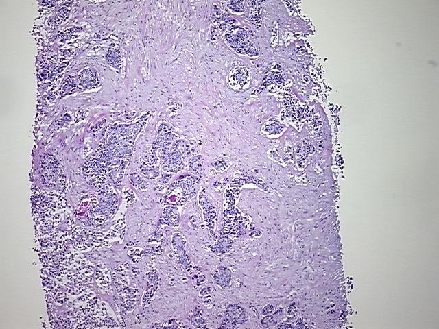4x Image