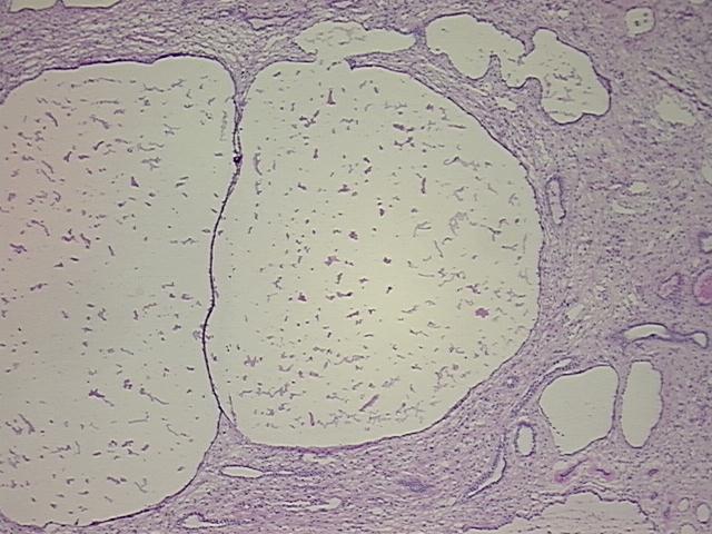 4x Image