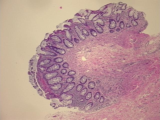 4x Image
