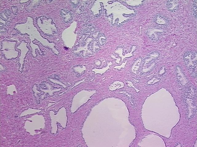 4x Image