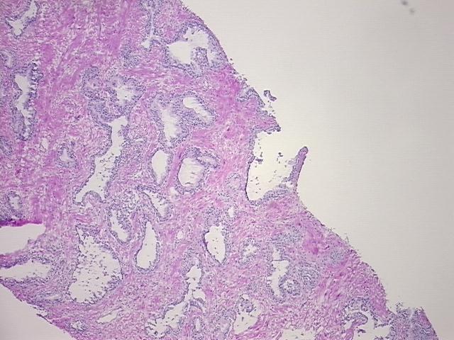 4x Image