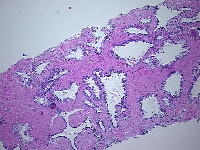 4x Image