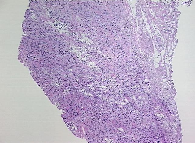 4x Image
