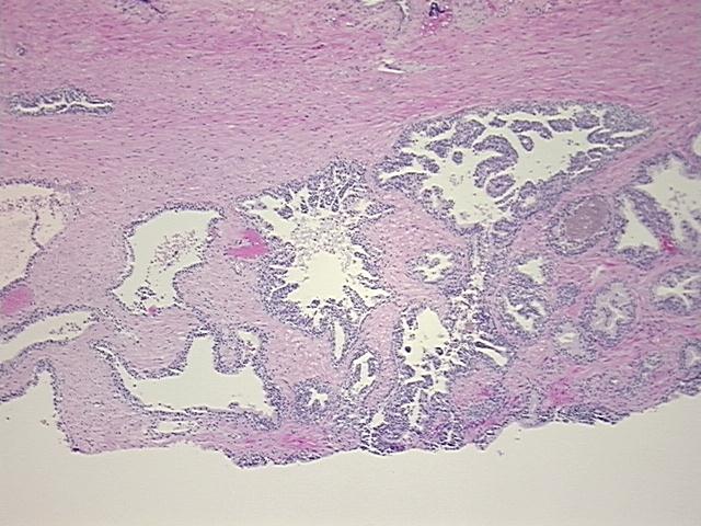 4x Image