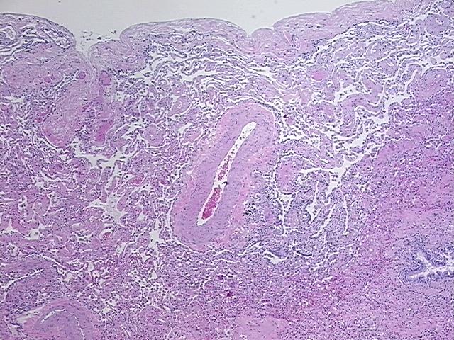 4x Image