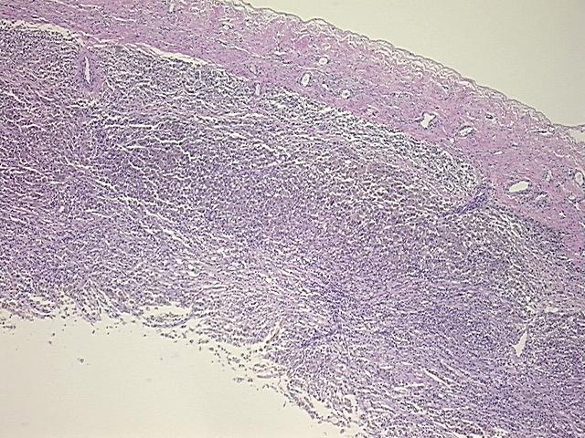 4x Image