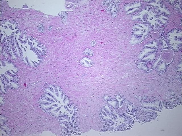 Tissue Sections (5x5um), FFPE; Prostate; Within normal