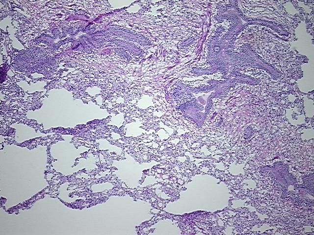 4x Image