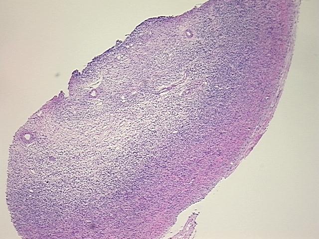 とまとページ Tissue Sections (5x5um), Frozen; Ovary; Within normal limits