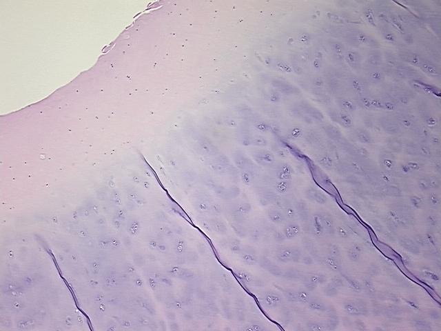 4x Image