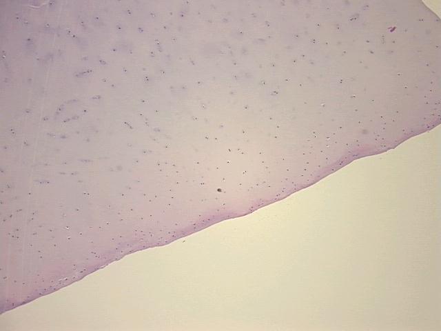 4x Image