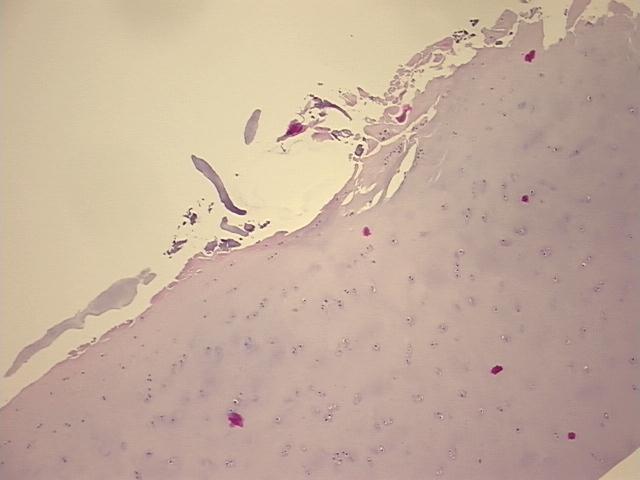 4x Image