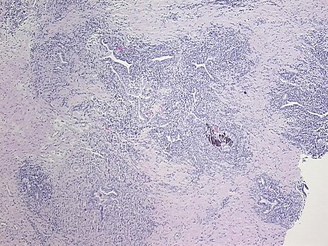 4x Image