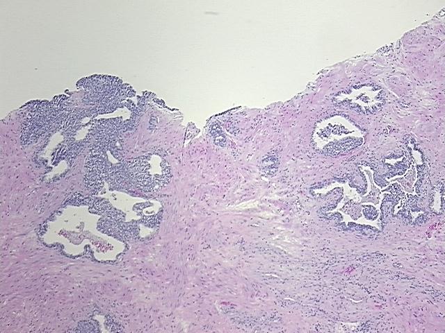 4x Image