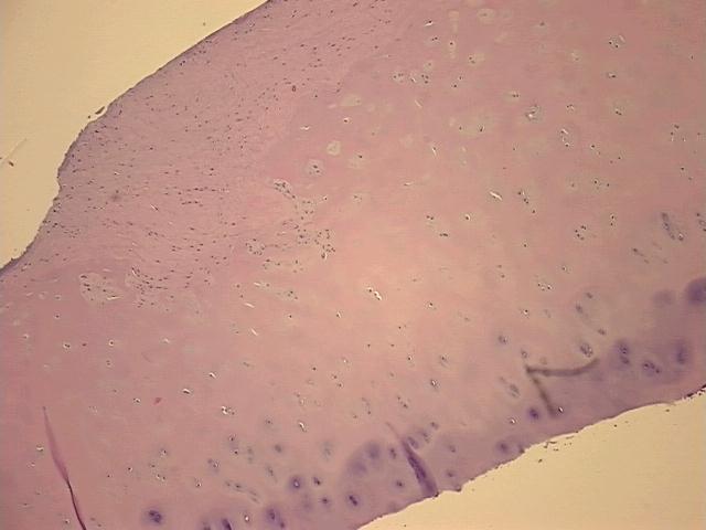 4x Image