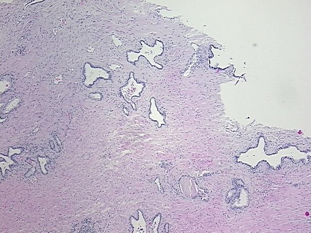 4x Image